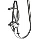 Brida Anatomic